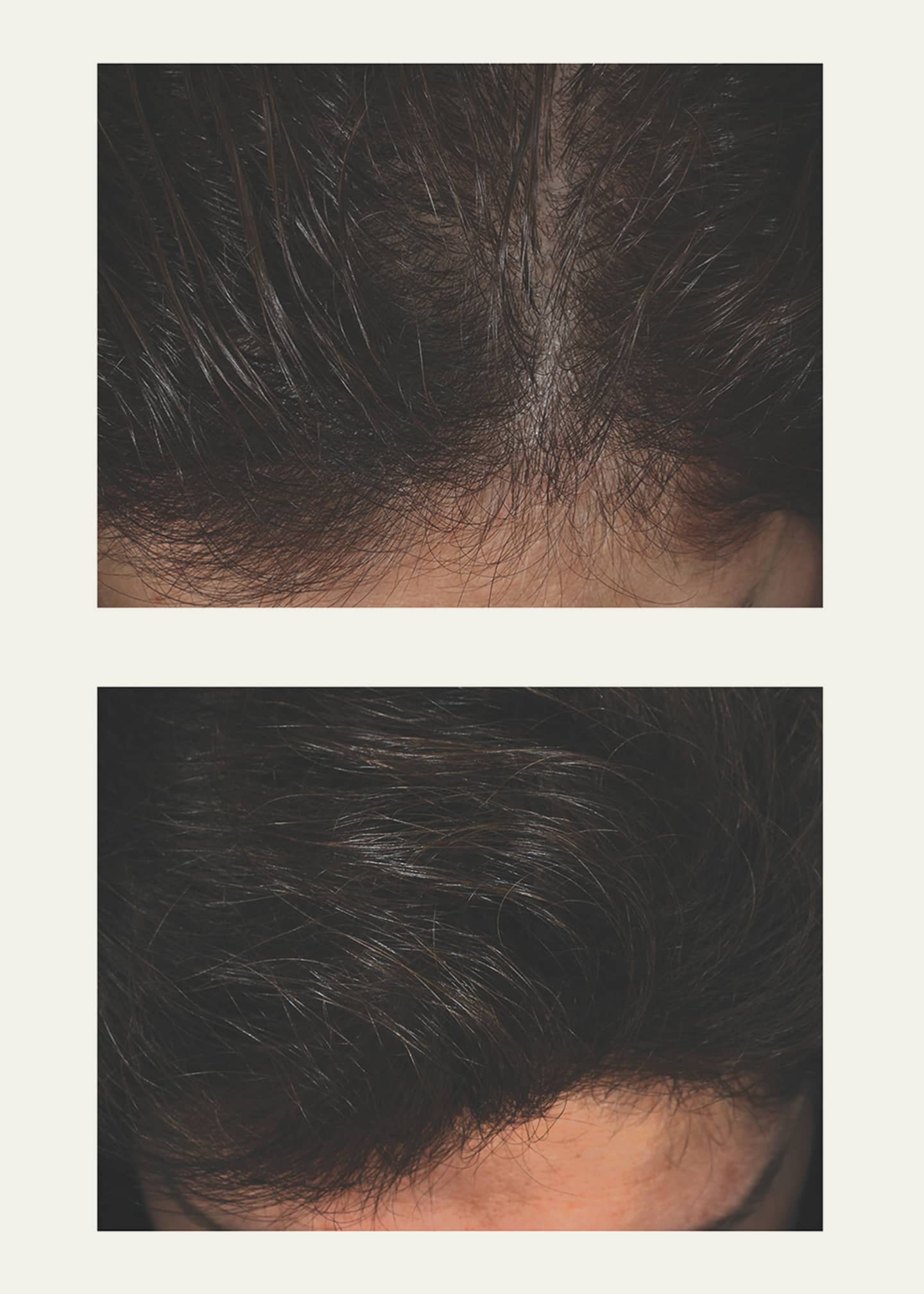 NeuLash by Skin Research Laboratories 2.7 oz. Hair Enhancing Formula Image 5 of 5