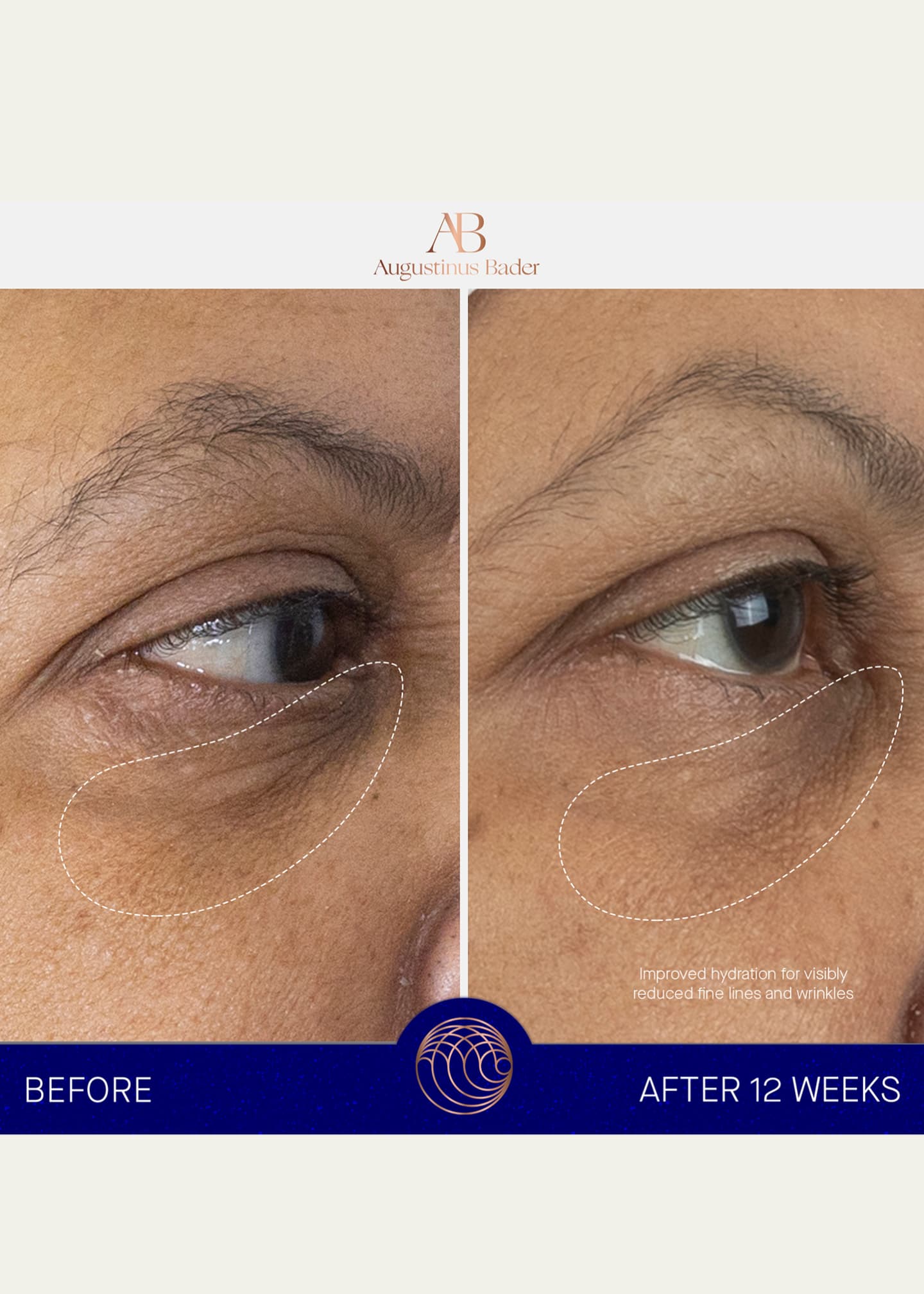 Augustinus Bader The Eye Cream Refill, 0.5 oz. Image 5 of 5