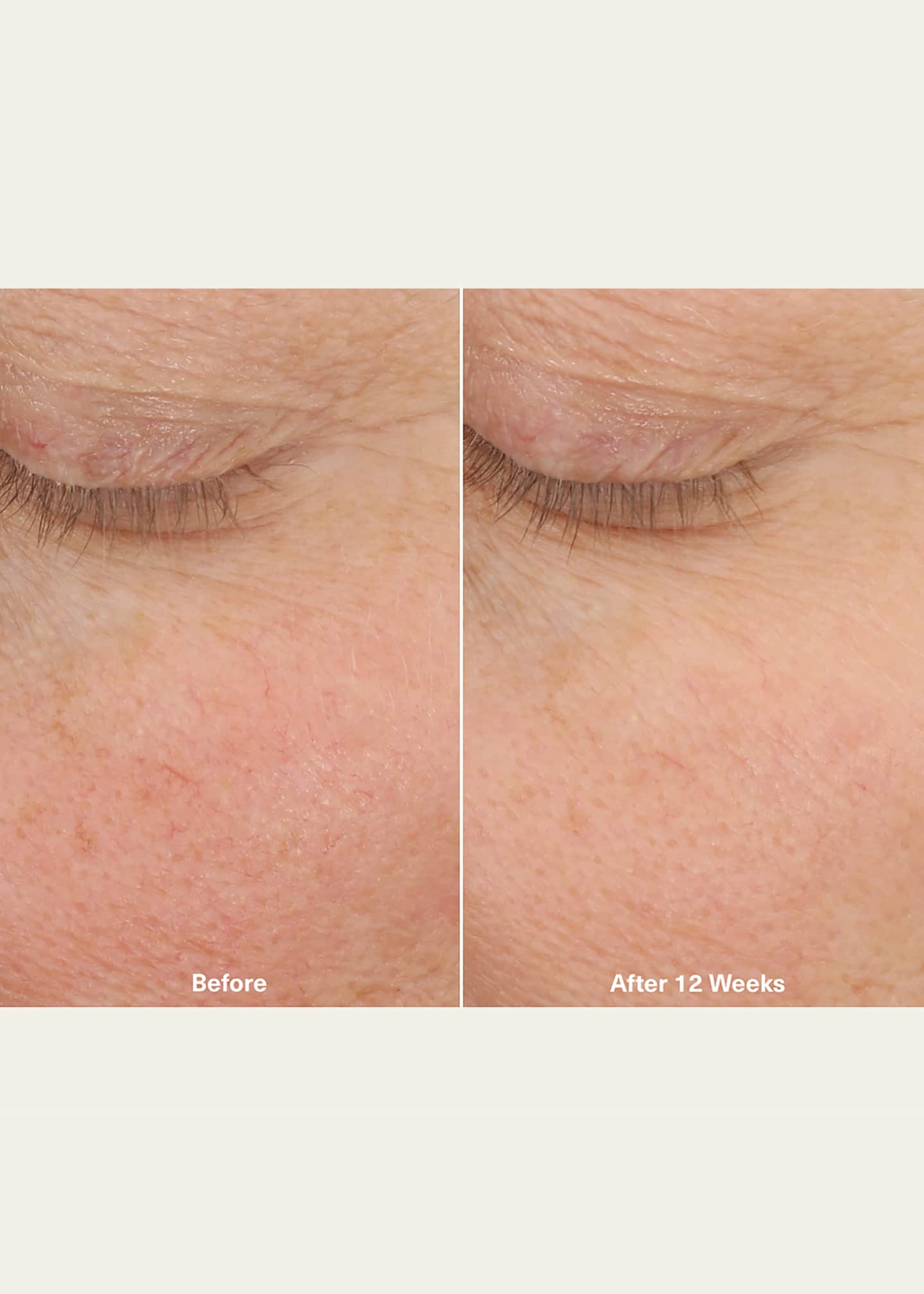 La Mer The Micro Peel Treatment, 1 oz. Image 4 of 5