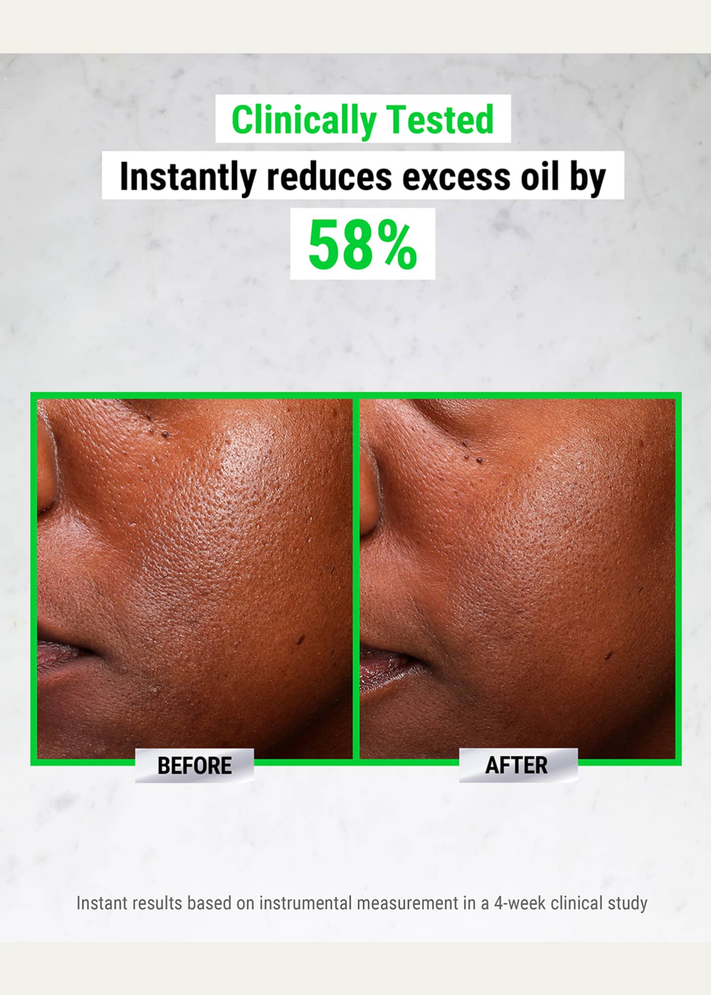 Kiehl's Since 1851 Ultra Pure High-Potency 5% Niacinamide Serum, 1 oz. Image 2 of 5