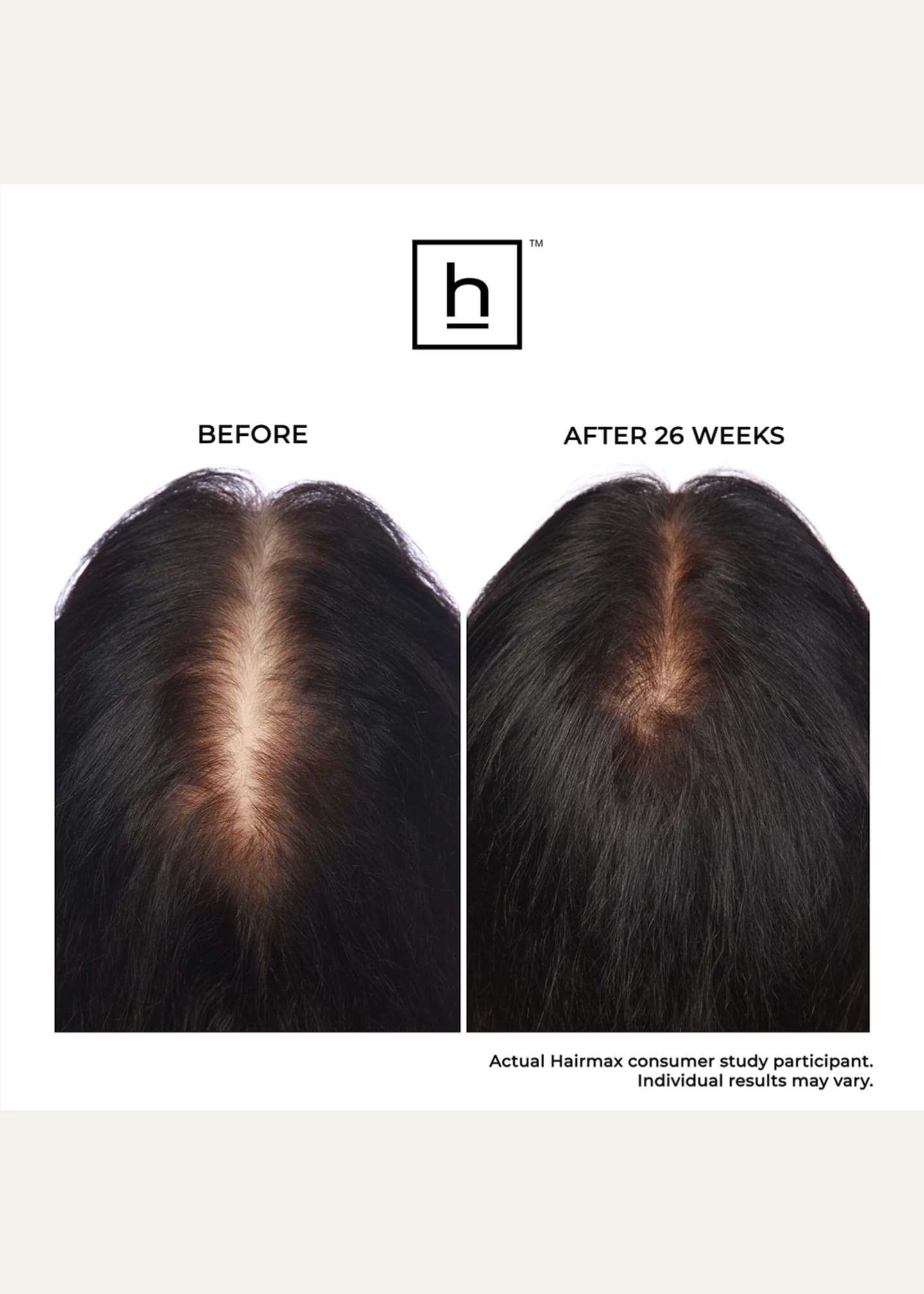 Hairmax LaserBand 82 ComfortFlex Hair Growth Device Image 3 of 3