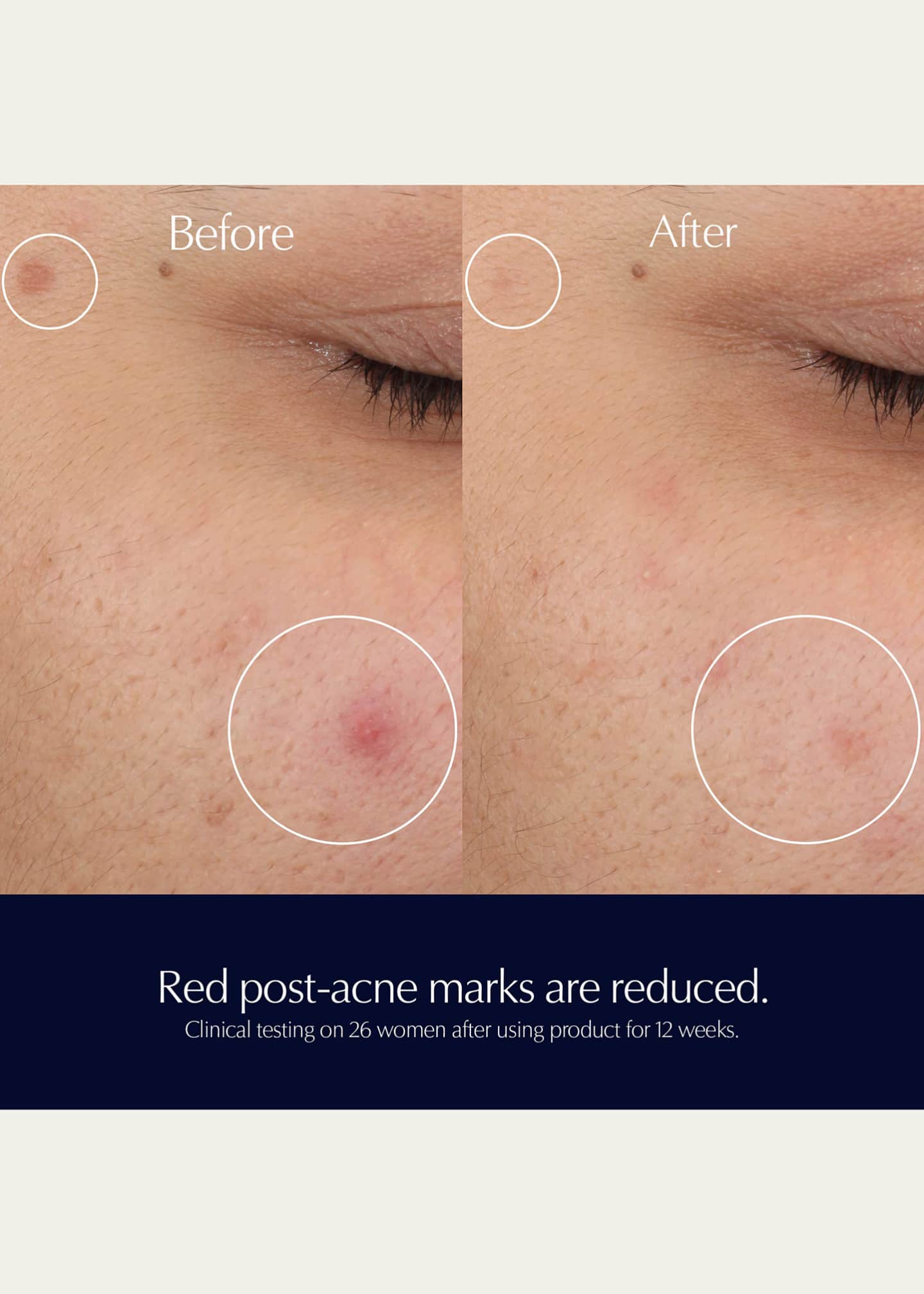 Estee Lauder Advanced Night Repair Rescue Solution Serum with 15% Bifidus Ferment, 0.68 oz. Image 5 of 5