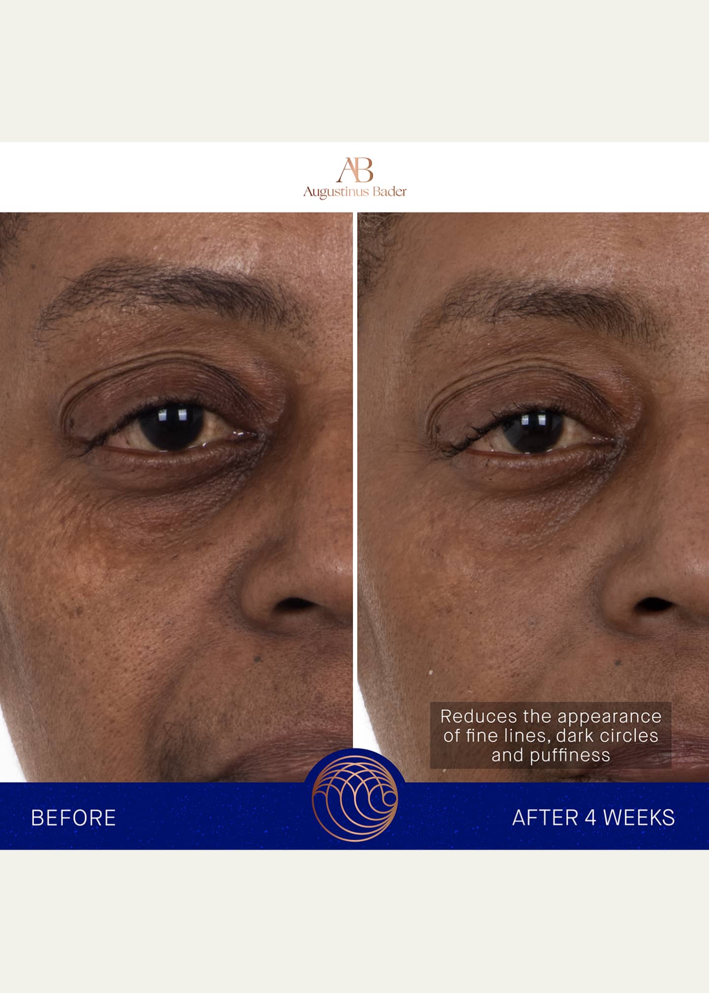 Augustinus Bader The Eye Patches with TFC8, 1 Pack Image 5 of 5