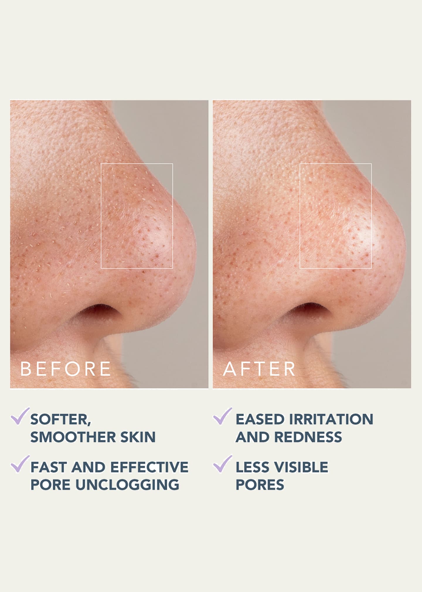 Foreo KIWI Active Pore & Blackhead Mask Image 4 of 4