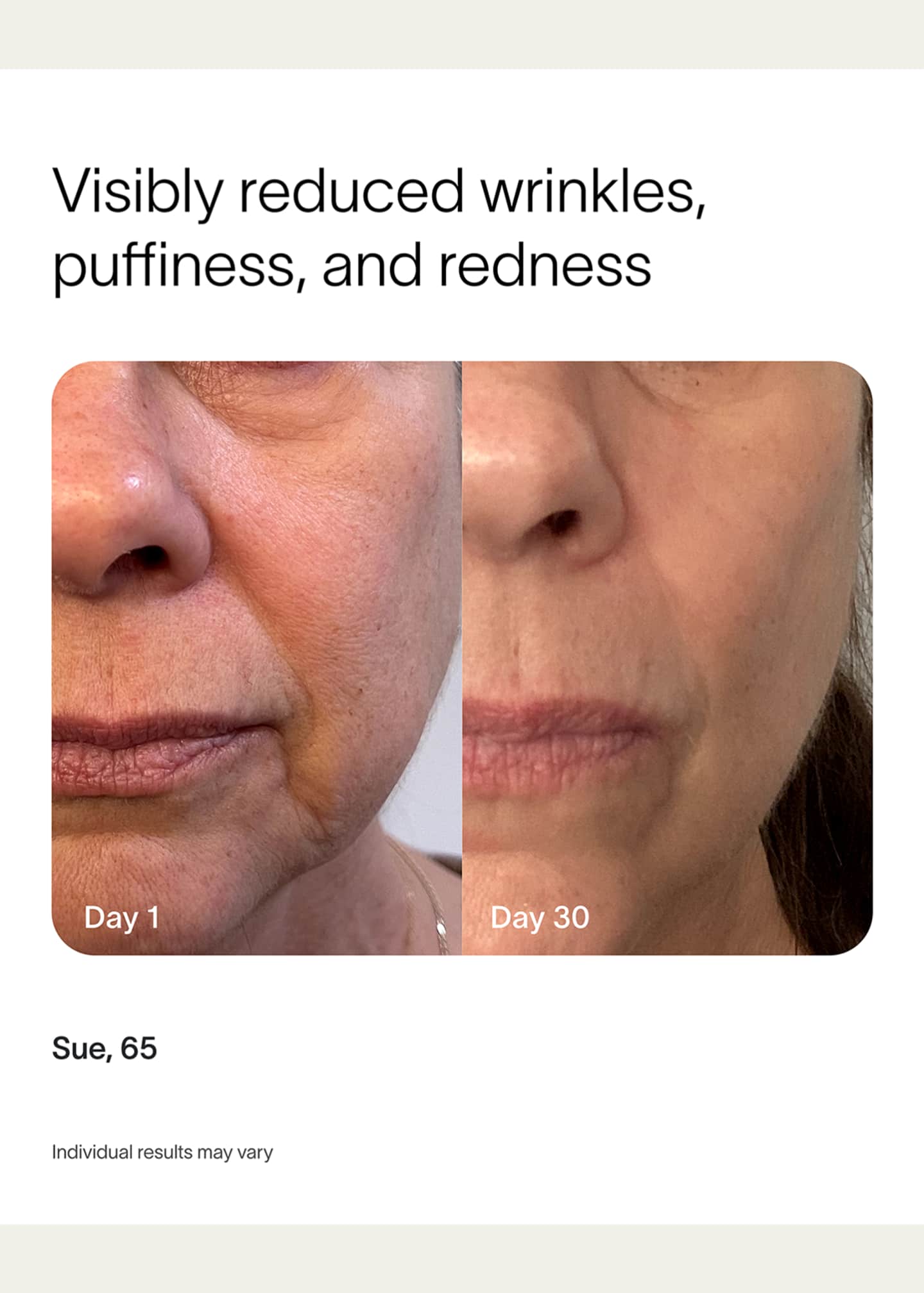 SolaWave Radiant Renewal Red Light Therapy Starter Kit - Bergdorf Goodman