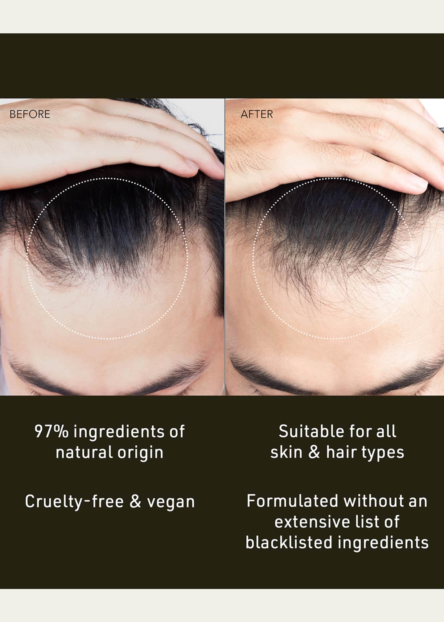 Foreo FAQ Scalp Recovery & Thick Hair Probiotic Serum Image 4 of 4