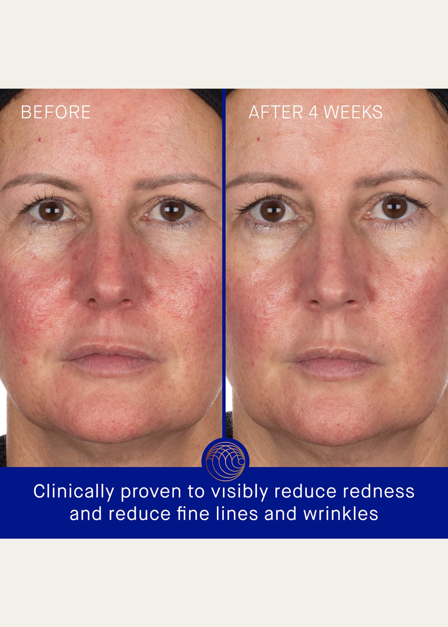 Augustinus Bader The Hydrogel Face Mask, 6 pack Image 4 of 5