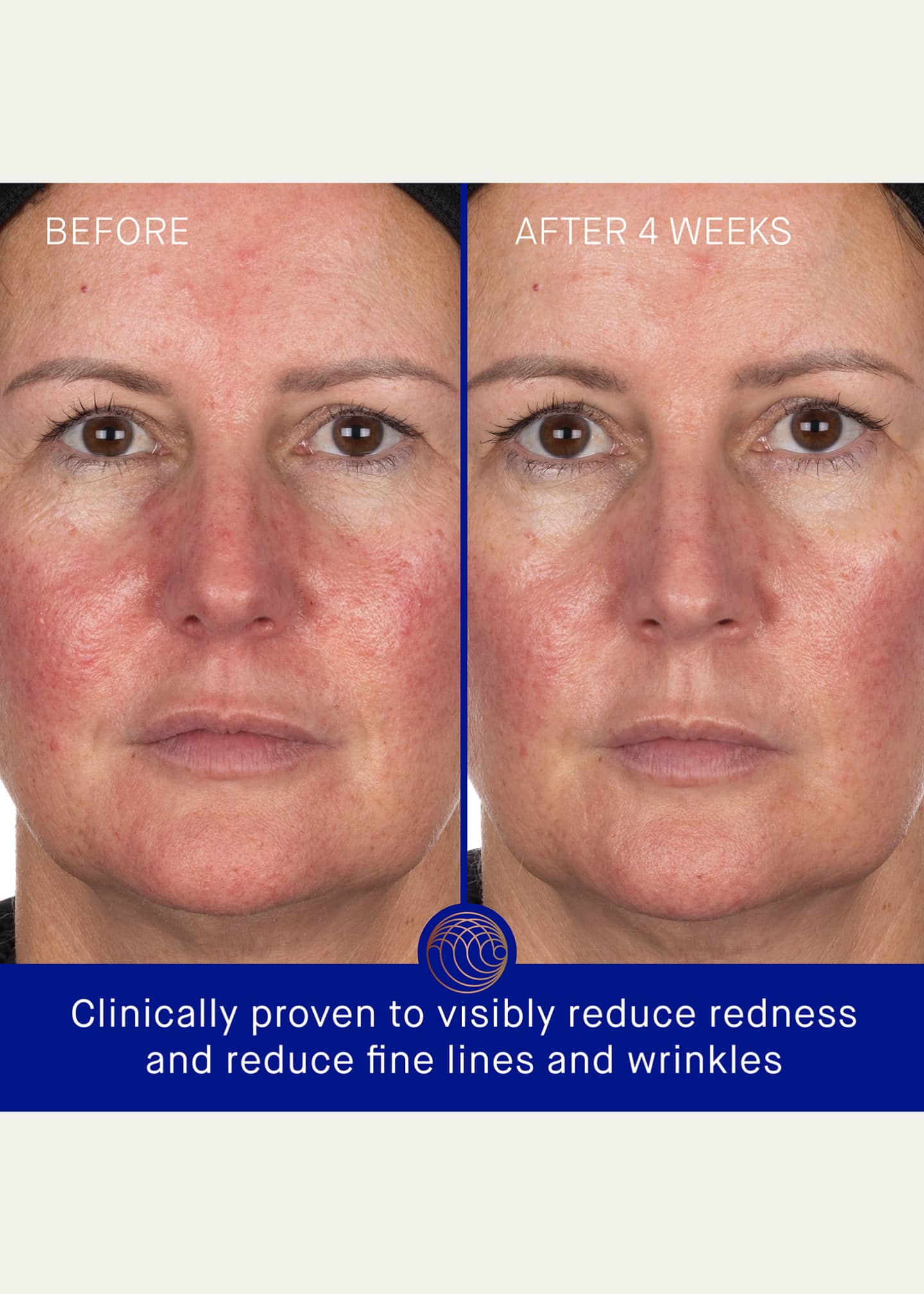 Augustinus Bader The Hydrogel Face Mask, Single Image 4 of 5