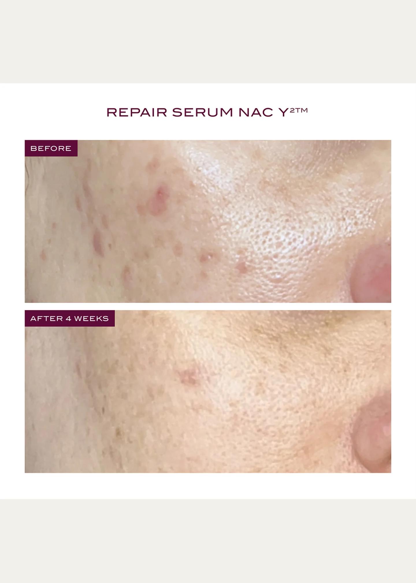 111SKIN Reparative Icons 3-Piece Skincare Set ($445 Value) - Bergdorf ...