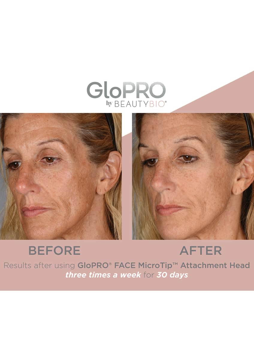 Beautybio Glopro Microneedling Regeneration Tool Bergdorf Goodman